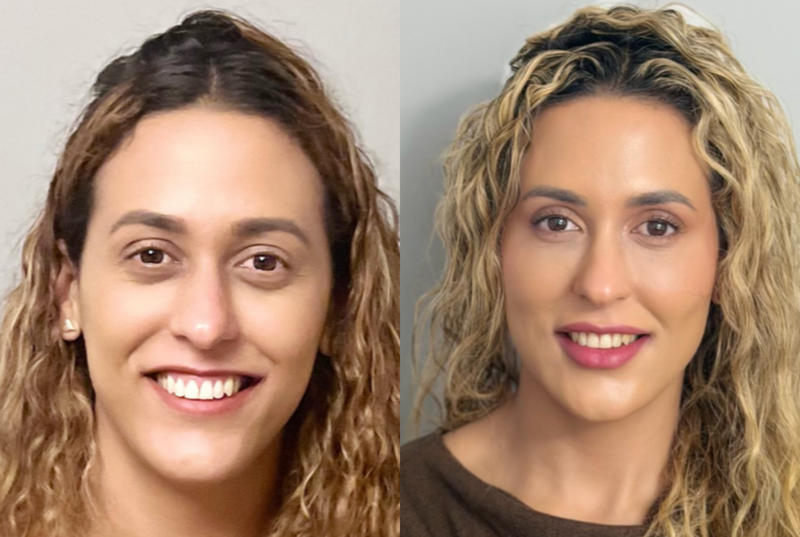 Dermal Fillers (Hyaluronic Acid)